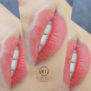 Môi Thẩm Mỹ